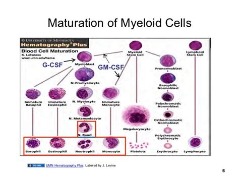Myeloid Leukemia Slideshare Introduction To Leukemia
