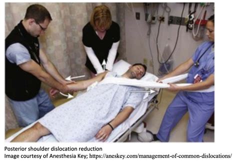 Emergency Medicine Educationem3am Posterior Shoulder