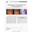 PDF Differential Diagnosis Of Ulcers Throughout The Colon