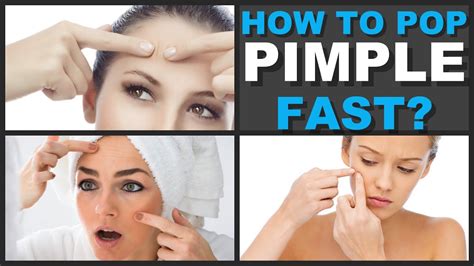 How To Pop A Pimple Fast Naturally At Home Pop Pimple Home Remedies