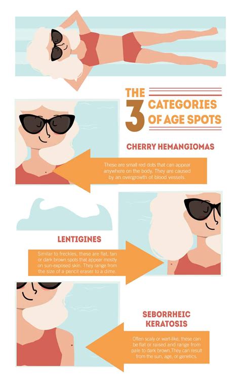 All About Age Spots Causes Treatment And Prevention