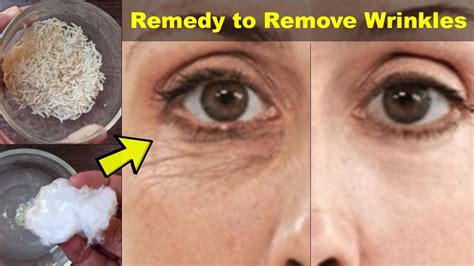 How To Remove Wrinkles From Face At Home Best Remedy To Remove