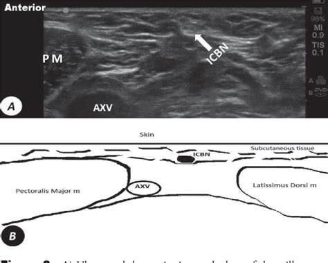 Figure 2 From Ultrasound Imaging Accurately Identifies The