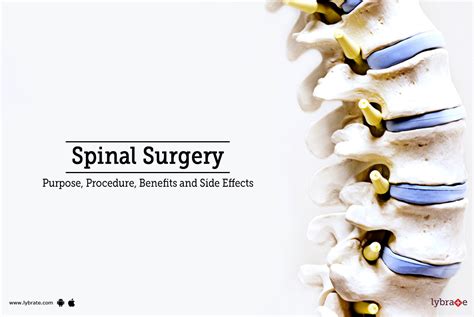 Spinal Surgery Types Recovery Risks And Benefits