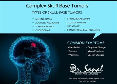 Complex Skull Base Tumors Spine Surgery Brain Tumor Brain Surgery