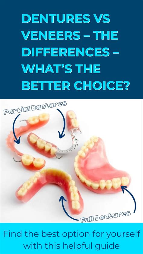 Dentures Vs Veneers The Differences Whats The Better Choice And A