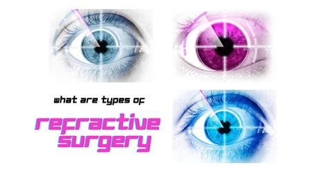 Types Of Refractive Surgery V1 Board Certified Eye Doctors