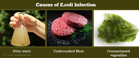 E Coli Infection Escherichia Coli Infection Causes Diagnosis Symptoms Treatment Risk