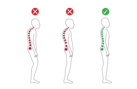 Our Ealing Chiropractor Explains The 3 Most Common Postural Problems