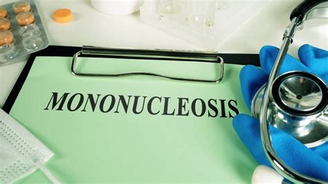 Mononucleosis La Enfermedad Del Beso Que Debes Conocer Enfermedades