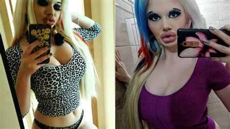 Who Is Andrea Ivanova Barbie That Have The Largest Lips In The World