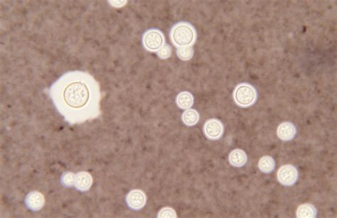 Cryptococcus Neoformans Doccheck