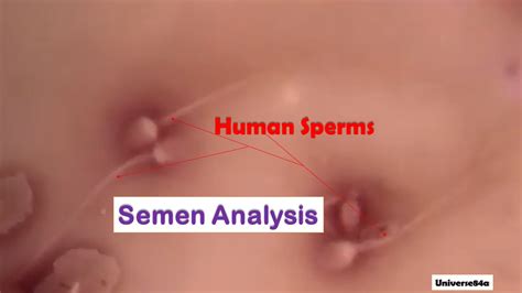 Semen Test Introduction Physical Chemical Microscopic Examination