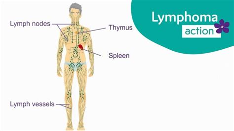 Lymphoma Action About Lymphoma