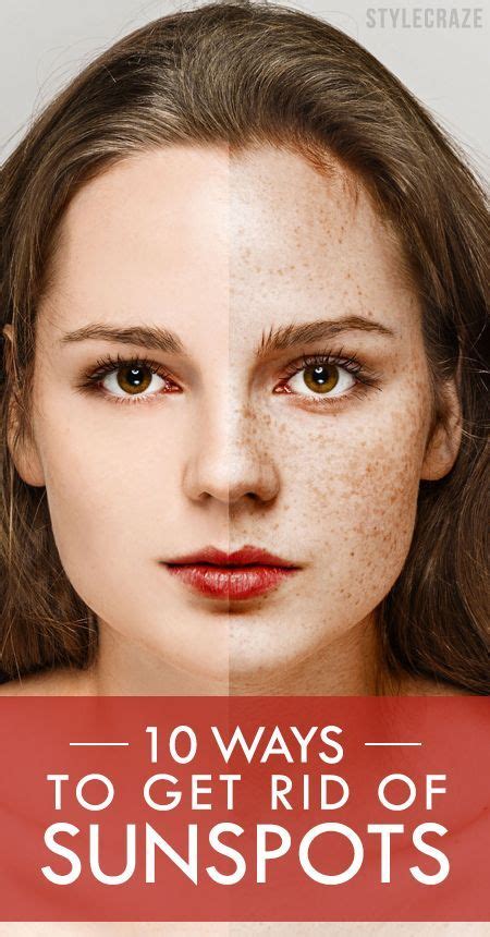12 Simple Ways To Get Rid Of Sunspots Brown Spots On Skin Brown Spots On Face Spots On Face