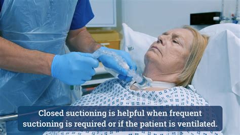 Trach Suctioning Video