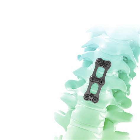 Significance Of Spine Implants In Orthopedic Surgery Zealmax