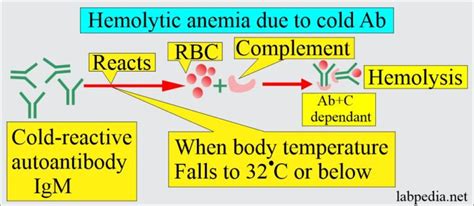 Anemia Part 8 Hemolytic Anemias Classification Autoimmune