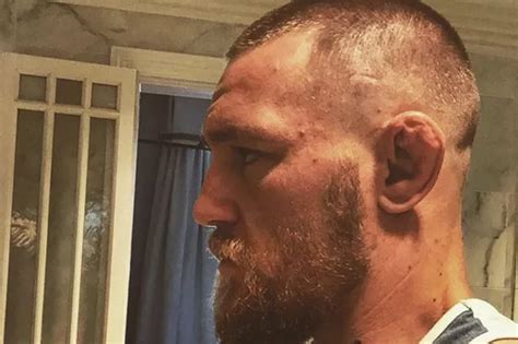 Conor Is Going Bald At The Age Of 27 Sherdog Forums Ufc Mma