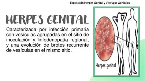 Herpes Genital Y Verrugas Genitales