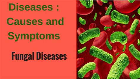 Diseases Fungal Diseases Youtube