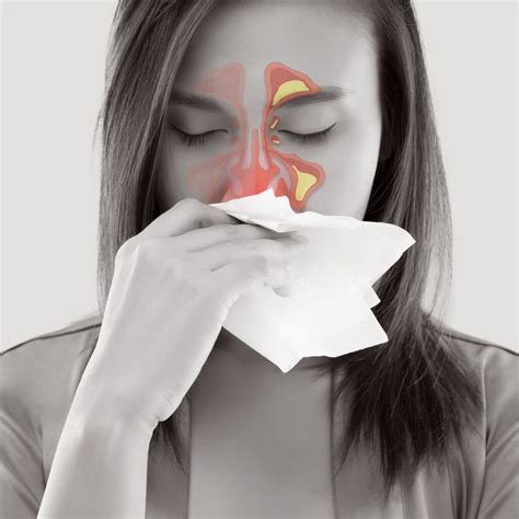 Nose Sinuses And Allergy The Voice Clinic