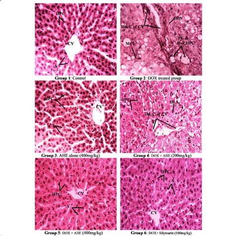 Histopathological Examination Of Rat Liver H E Staining Magnification
