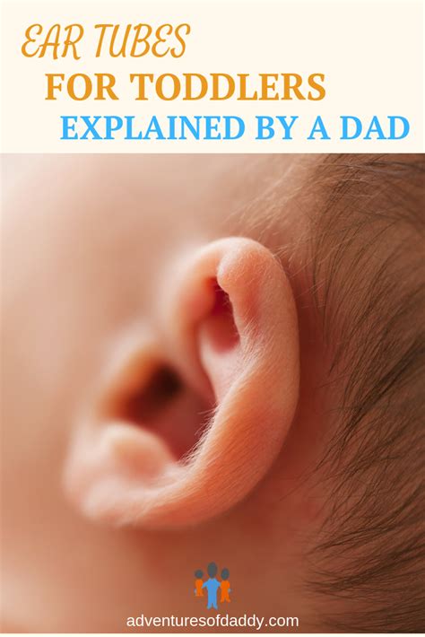 Ear Tubes For Toddlers Explained By A Dad Adventures Of Daddy