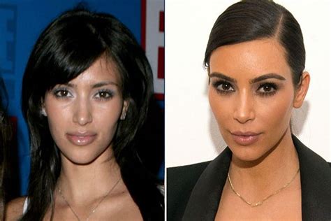 Hollywood Celebs Who Looked Better Before Plastic Surgery Kim