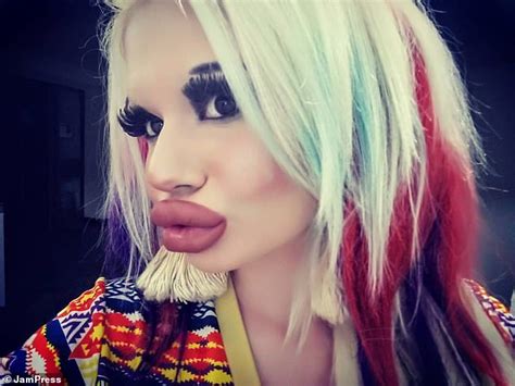 Woman Triples The Size Of Her Lips In A Bid To Be More Fashionable