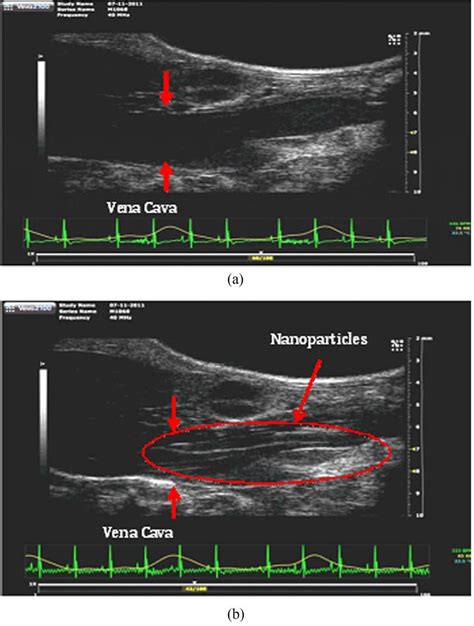 High Frequency Ultrasound Images Of The Blood Vessel In The Heart Of A