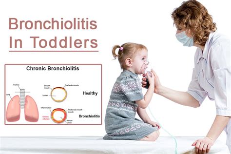 Bronchiolitis In Toddlers Causes Symptoms And Treatments