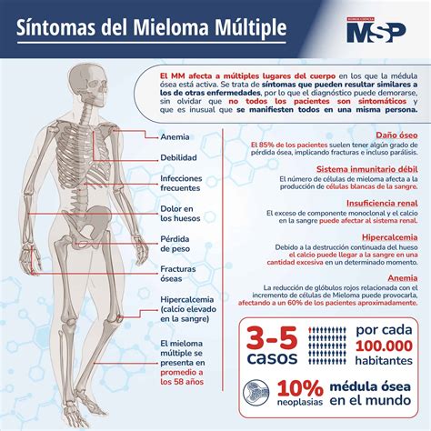 Síntomas Del Mieloma Múltiple Infografía