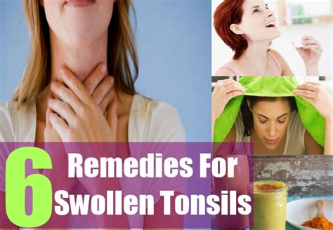 6 Ways To Treat Swollen Tonsils Home Remedies For Swollen Tonsils