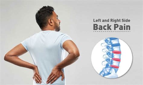 How To Get Cured With The Help Of Back Pain Treatment