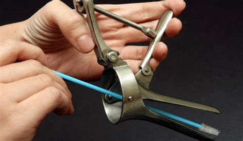 A pap smear is a medical test that helps doctors figure out if there are any problems with a girl's cervix. ANA RAHMAN