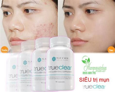 Viên Uống Trị Mụn Navan Trueclear Skin Clarifying Supplement 90 Viên