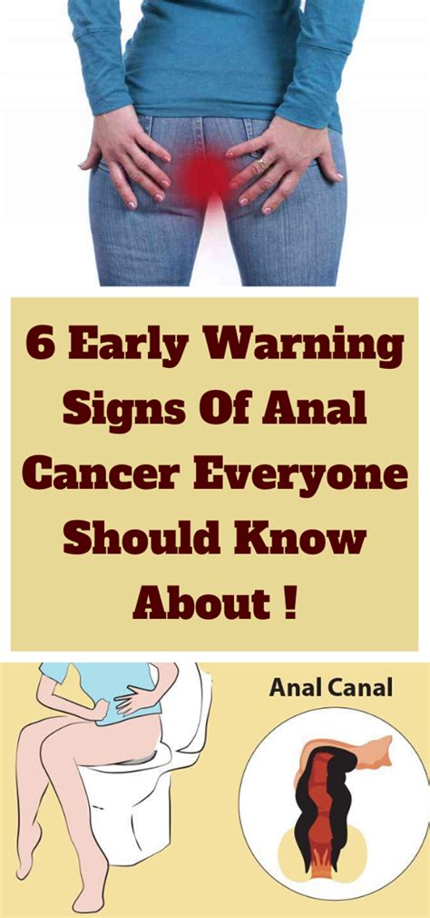 Early Warning Signs Of Anal Cancer Everyone Is Too Embarrassed To
