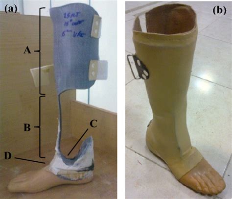 Figure From A Novel Prosthesis Design To Improve Partial Foot