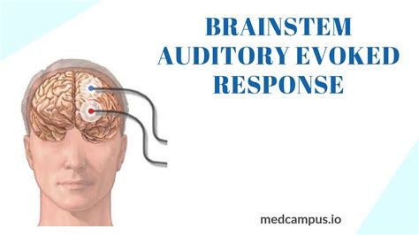 Baer Brainstem Auditory Evoked Response Test Youtube