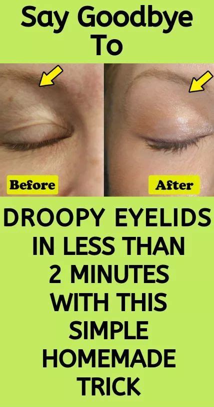 Learn How To Get Rid Of Droopy Eyelids In Less Than 2 Minutes With This