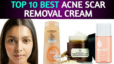 Best Acne Scar Removal Creams In India With Prices Youtube