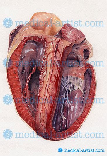 Professional Medical Illustrations And Medical Legal Illustration By Medical Artist Joanna Culley