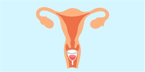 Pros And Cons Of Menstrual Cups Pristyn Care