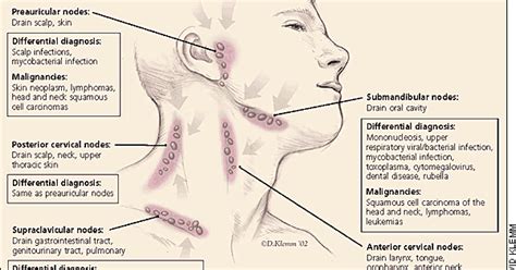 Trouble With Lymph Nodes Specifically Subclavicular Lymph Nodes