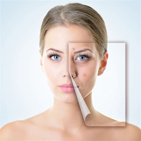 Treat Skin Imperfections With Regular Facials
