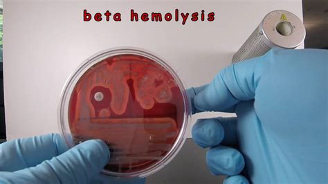 Staphylococcus Aureus On Blood Agar With A Nb Disc Youtube