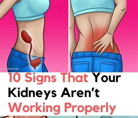 Is Your Kidney On Your Left Side