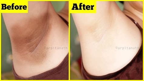 Whiten Dark Underarms Instantly Remove Unwanted Body Hair 100 Natural Youtube