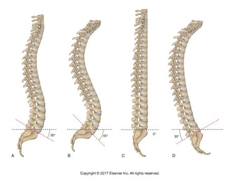 Elongation Of The Spine